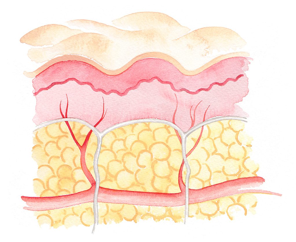 Illustration Medical Cellulite Cross Section Diagram