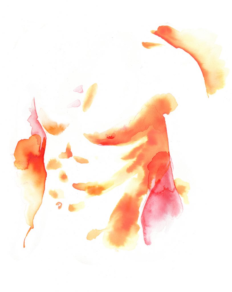 Illustration Medical Plastic Surgery Male Gynaecomastia